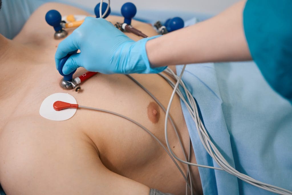 Is Getting a PET Scan Serious? Your Essential Guide 1 cardiac procedure