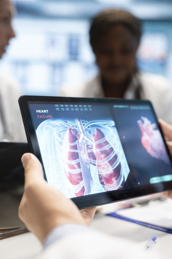 medics his staff meet discuss lungs radiography patient care strategy LIV Hospital