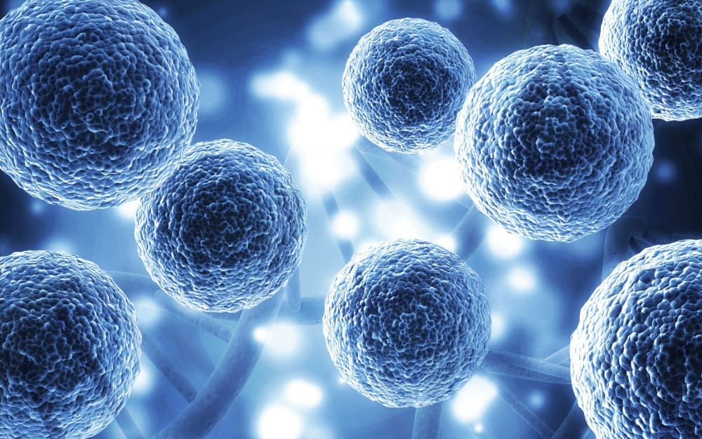 What is the most successful stem cell therapy? 1 Stem cell research in laboratory with scientists working on regenerative medicine.