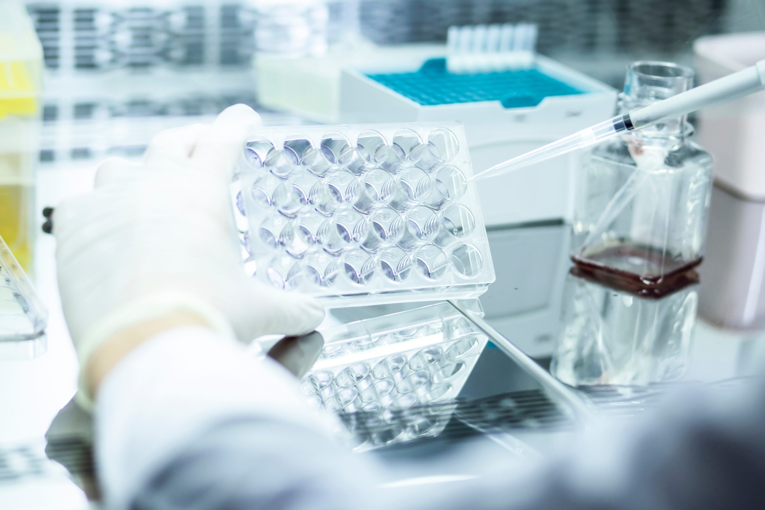 Risks of Allogeneic Stem Cell Transplant