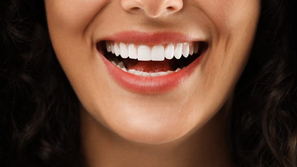Teeth Whitening