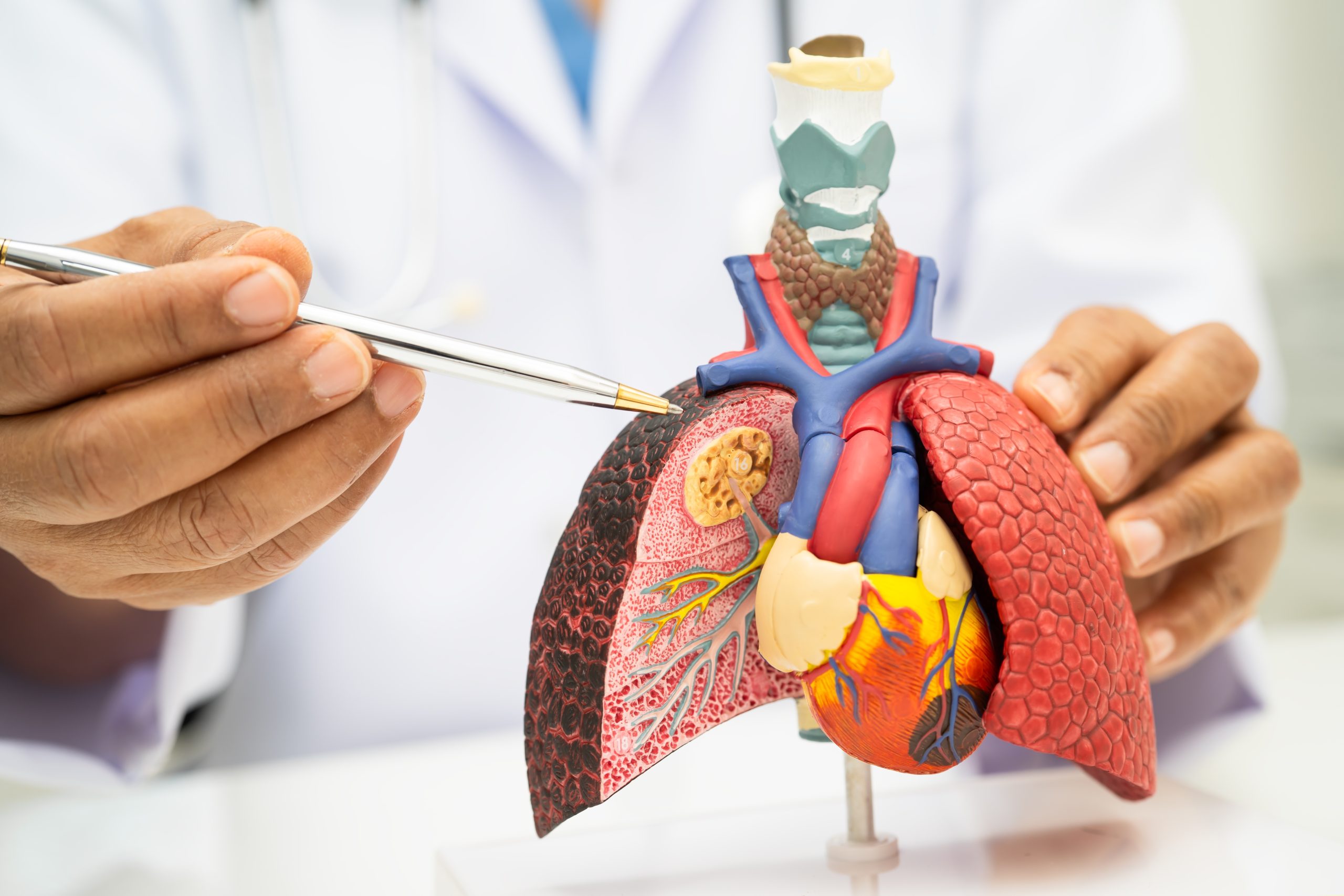 Can you be cured of lung cancer?