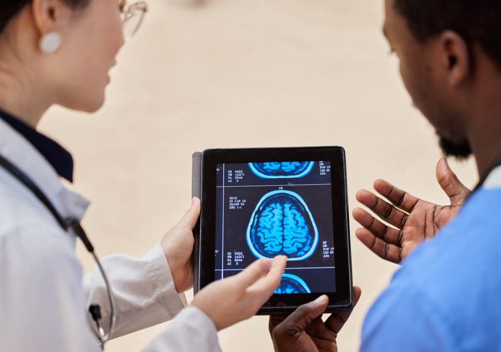 Will a SPECT Scan Show a Brain Tumor? How It Works & What to Expect