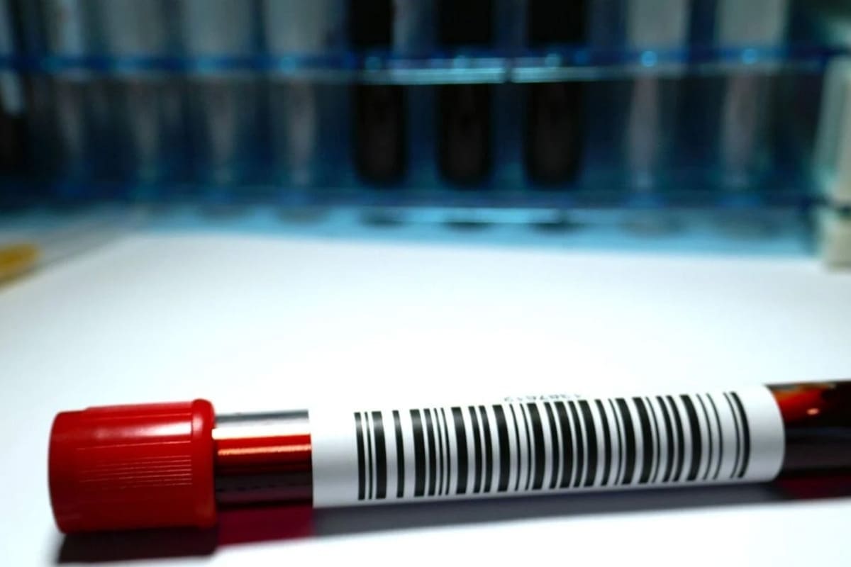 Thrombocytopenia: Crucial Critical Level