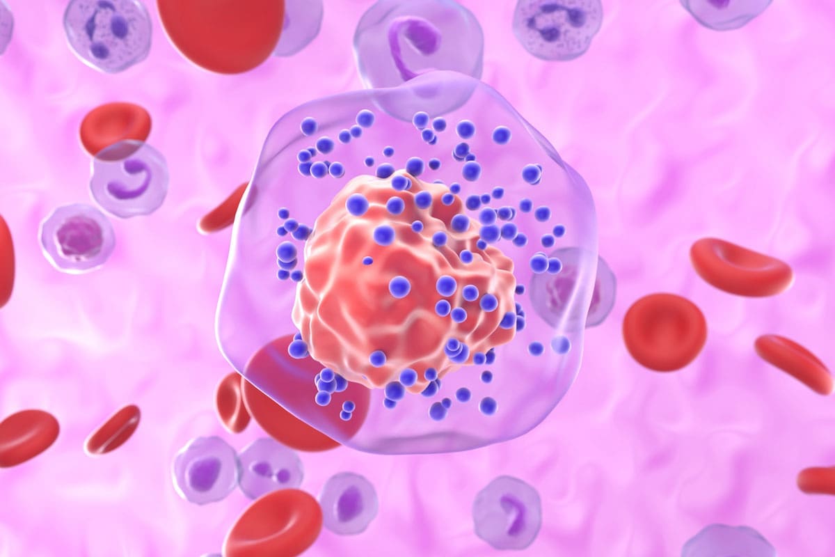 Risk Factors: Crucial 7 That Lead to Cancer