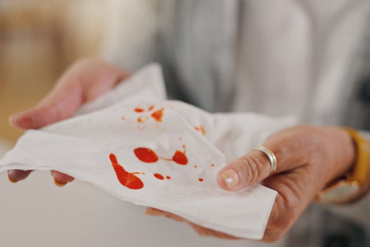 Thrombocytopenia: Dangerous Bleeding Onset