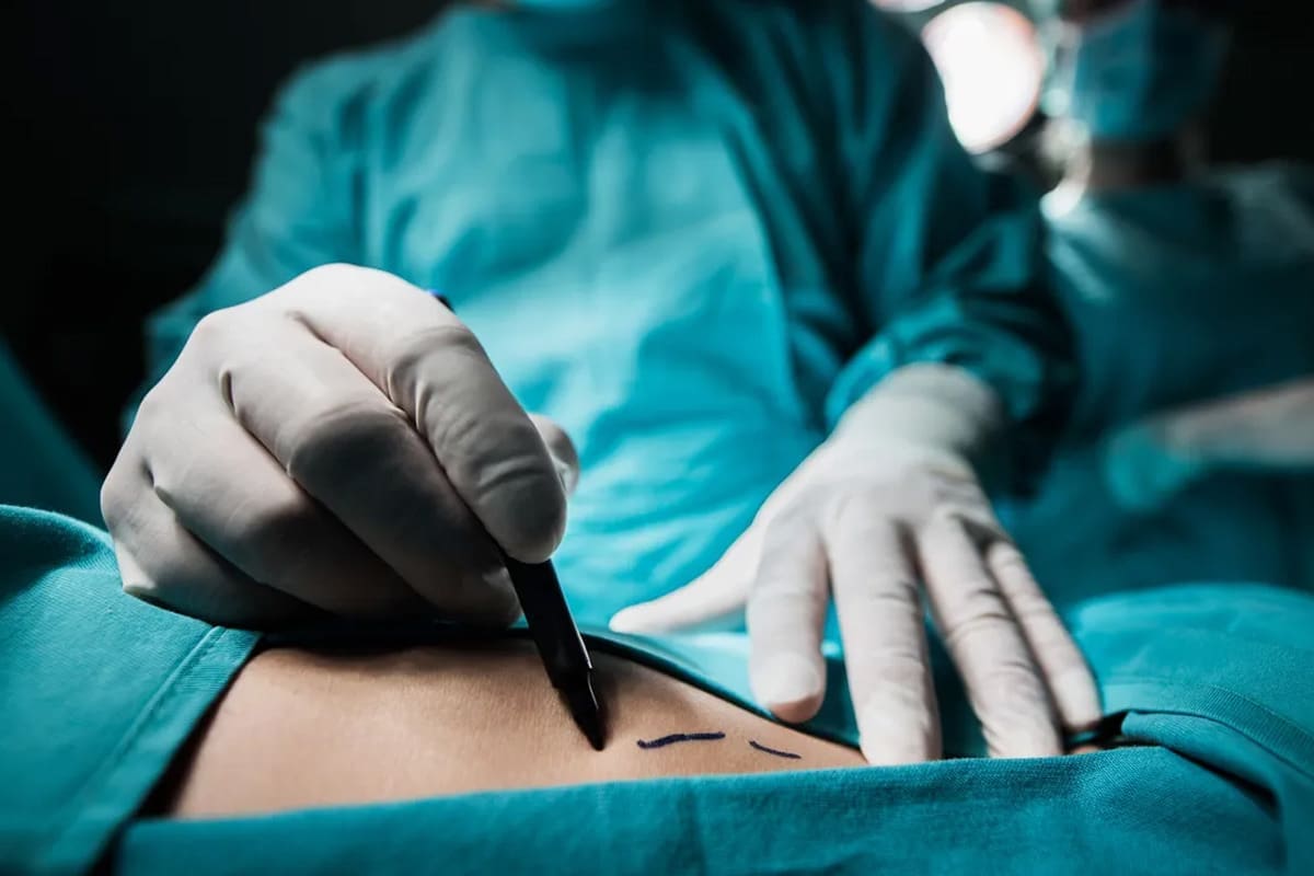 What Is Top Surgery for Minors? Transgender Surgery Overview