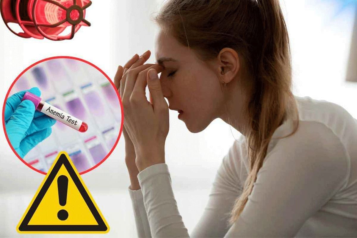 Unusual Symptoms Iron Deficiency Anemia: Shocking List