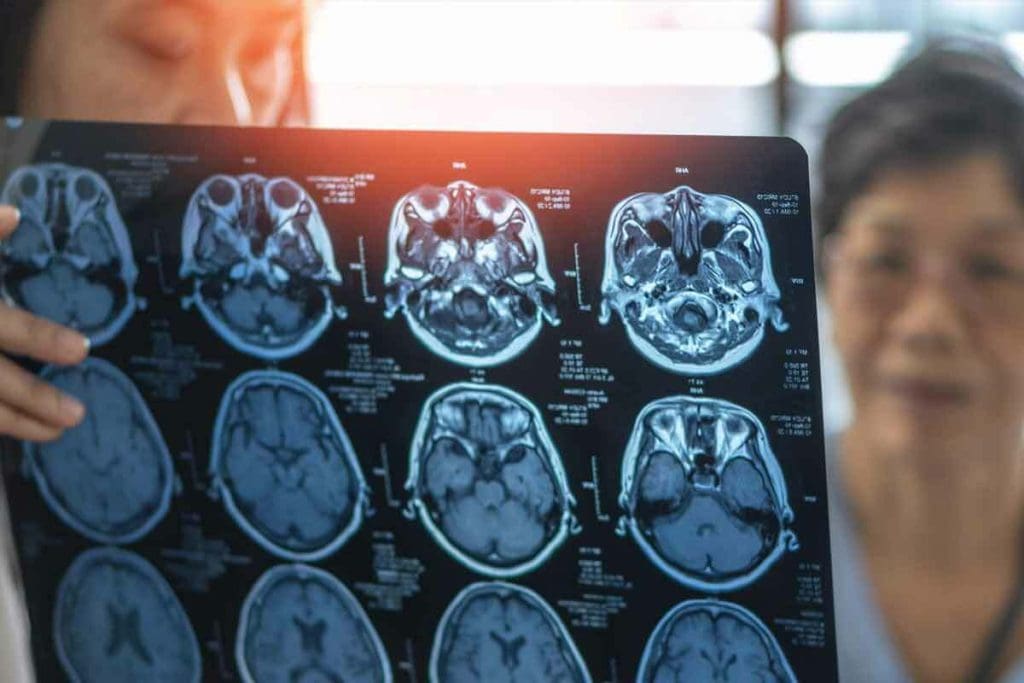 MRI Tumor: 7 Key Facts 3 MRI Tumor: 7 Key Facts