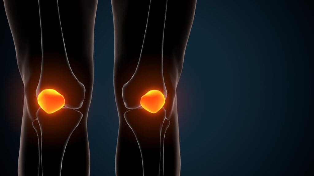 A close-up view of a human knee A close-up view of a human knee