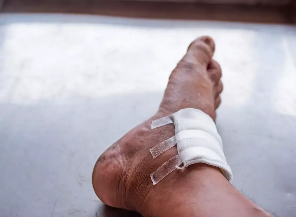 A detailed anatomical cross-section of a human knee joint, exposing a torn ligament. The foreground shows the ligament fibers in a frayed, distorted state, with the surrounding joint capsule and synovial membrane visible. The middle ground features the tibia, fibula, and femur bones in high detail, with their articulating surfaces and joint spaces clearly defined. The background softly fades into an abstract, clinical atmosphere, with muted hues and subtle grid-like patterns, evoking a sense of medical examination. Crisp, high-contrast lighting casts dramatic shadows, highlighting the structural integrity of the joint components and the traumatic nature of the injury. A technical, yet visually engaging depiction of a torn knee ligament, suitable for educational and medical illustration purposes. A detailed anatomical cross-section of a human knee joint, exposing a torn ligament. The foreground shows the ligament fibers in a frayed, distorted state, with the surrounding joint capsule and synovial membrane visible. The middle ground features the tibia, fibula, and femur bones in high detail, with their articulating surfaces and joint spaces clearly defined. The background softly fades into an abstract, clinical atmosphere, with muted hues and subtle grid-like patterns, evoking a sense of medical examination. Crisp, high-contrast lighting casts dramatic shadows, highlighting the structural integrity of the joint components and the traumatic nature of the injury. A technical, yet visually engaging depiction of a torn knee ligament, suitable for educational and medical illustration purposes.