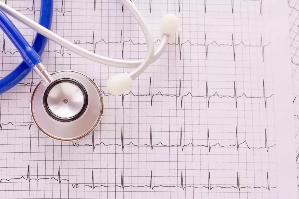 A detailed anatomical illustration depicting the various types of atrial fibrillation. In the foreground, a cross-section of the heart shows the abnormal electrical patterns associated with paroxysmal, persistent, and permanent AFib. The middle ground features labeled diagrams of each AFib type, with clear visual cues to distinguish them. The background showcases a stylized, technical rendering of the heart's electrical conduction system, emphasizing the complex nature of this cardiac arrhythmia. Rendered in a muted, medical color palette with high-contrast lighting to accentuate the anatomical details. The overall composition conveys a sense of scientific authority and clinical precision, suitable for educating readers about the different manifestations of atrial fibrillation.