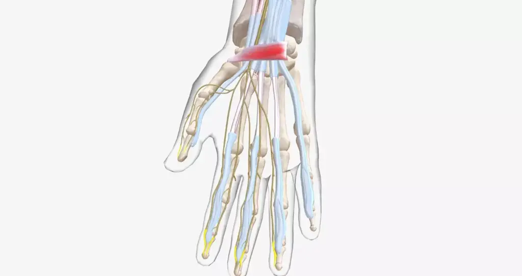A detailed anatomical illustration of the carpal tunnel in the wrist, showcasing the compressed median nerve and surrounding tendons. The image should have a clean, medical-illustration style with a neutral color palette, soft lighting, and a plain background to emphasize the structure and pathology. Capture the tension and constriction of the carpal tunnel from a slightly angled, close-up perspective, highlighting the key anatomical elements. Convey a sense of medical understanding and the need for potential surgical intervention, without being overly graphic or dramatic. A detailed anatomical illustration of the carpal tunnel in the wrist, showcasing the compressed median nerve and surrounding tendons. The image should have a clean, medical-illustration style with a neutral color palette, soft lighting, and a plain background to emphasize the structure and pathology. Capture the tension and constriction of the carpal tunnel from a slightly angled, close-up perspective, highlighting the key anatomical elements. Convey a sense of medical understanding and the need for potential surgical intervention, without being overly graphic or dramatic.