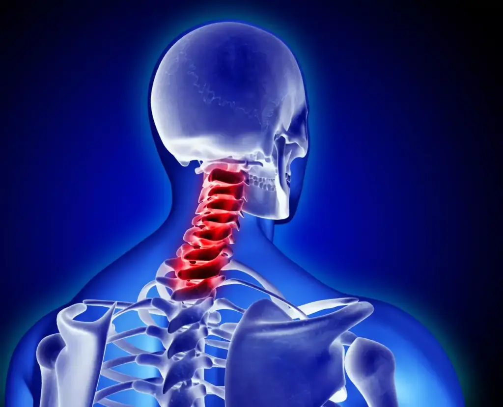 A detailed cross-section view of a cervical spine undergoing spinal fusion surgery. In the foreground, the surgeon's hands delicately manipulate surgical instruments, exposing the vertebrae and intervertebral discs. The middle ground reveals the intricate anatomy, with the spinal cord, nerve roots, and supporting structures visible. In the background, a sterile operating room setting with medical equipment and lighting casts a clinical, focused atmosphere. The image conveys the precision and complexity of this delicate neurosurgical procedure, highlighting the surgeon's expertise in restoring spinal stability and relieving neurological compression.