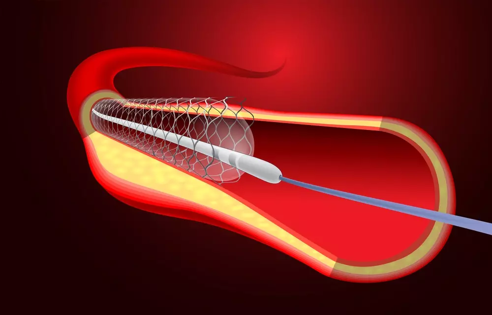 A detailed, cross-sectional illustration of the internal structure of bone marrow, showcasing the contrast between red and yellow marrow. A clinical, scientific aesthetic with precise anatomical labeling, illuminated by soft, diffuse lighting that accentuates the textures and cellular components. The image should depict the different marrow types in their natural locations within the bone, allowing the viewer to understand their distinct roles and distributions within the skeletal system.