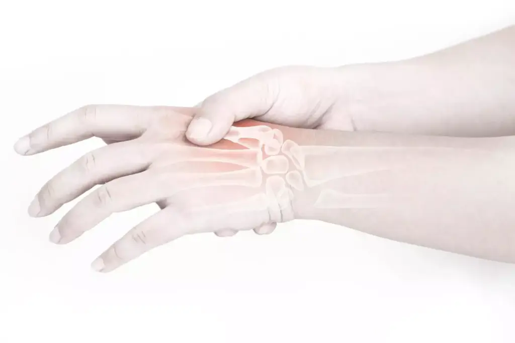 A detailed digital illustration depicting the prevalence of arthritis. A large, realistic human hand in the foreground, with joints and bones clearly visible, showcasing the effects of arthritis. In the middle ground, a world map with regions shaded to represent the global distribution and rates of arthritis, conveying its widespread impact. The background features a soothing, blurred medical/scientific atmosphere, with subtle lighting and a muted color palette to emphasize the informative nature of the image. The overall composition strikes a balance between the personal, individual experience of arthritis and its broader societal implications. A detailed digital illustration depicting the prevalence of arthritis. A large, realistic human hand in the foreground, with joints and bones clearly visible, showcasing the effects of arthritis. In the middle ground, a world map with regions shaded to represent the global distribution and rates of arthritis, conveying its widespread impact. The background features a soothing, blurred medical/scientific atmosphere, with subtle lighting and a muted color palette to emphasize the informative nature of the image. The overall composition strikes a balance between the personal, individual experience of arthritis and its broader societal implications.