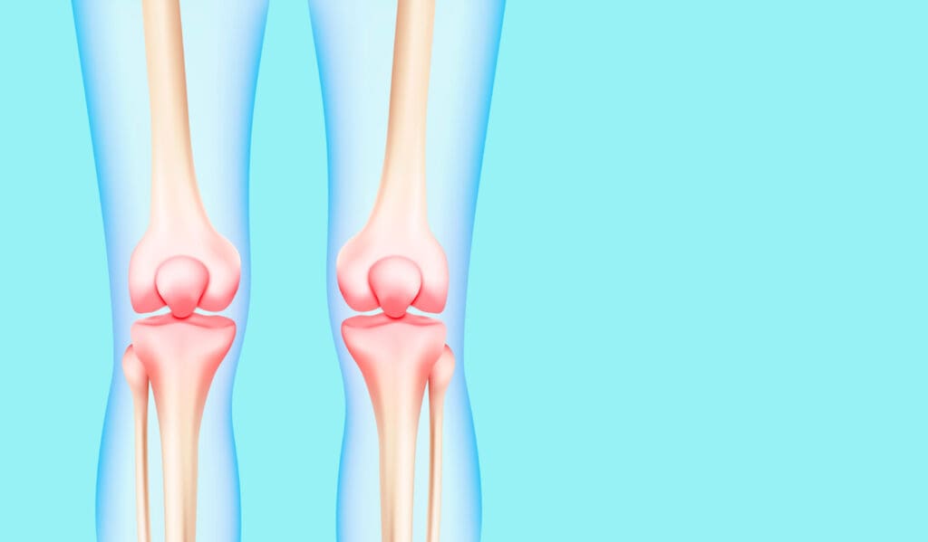 A detailed, high-resolution 3D render of a human knee joint undergoing a unicompartmental knee replacement procedure.