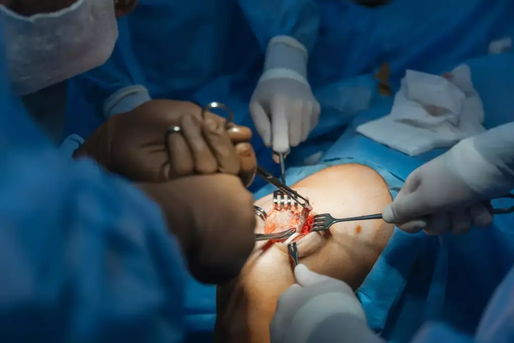 A detailed, high-resolution image of a knee replacement surgery procedure, with a clear view of the surgical site and the doctor's hands performing the operation. The scene is illuminated by bright, clinical lighting, creating a sense of precision and professionalism. The image should convey the complex, technical nature of the surgery, with visible surgical instruments and the prosthetic knee implant. The background should be a clean, sterile operating room environment, with a focus on the patient's leg and the surgeon's hands. The overall tone should be informative and educational, capturing the reality of the surgical process.