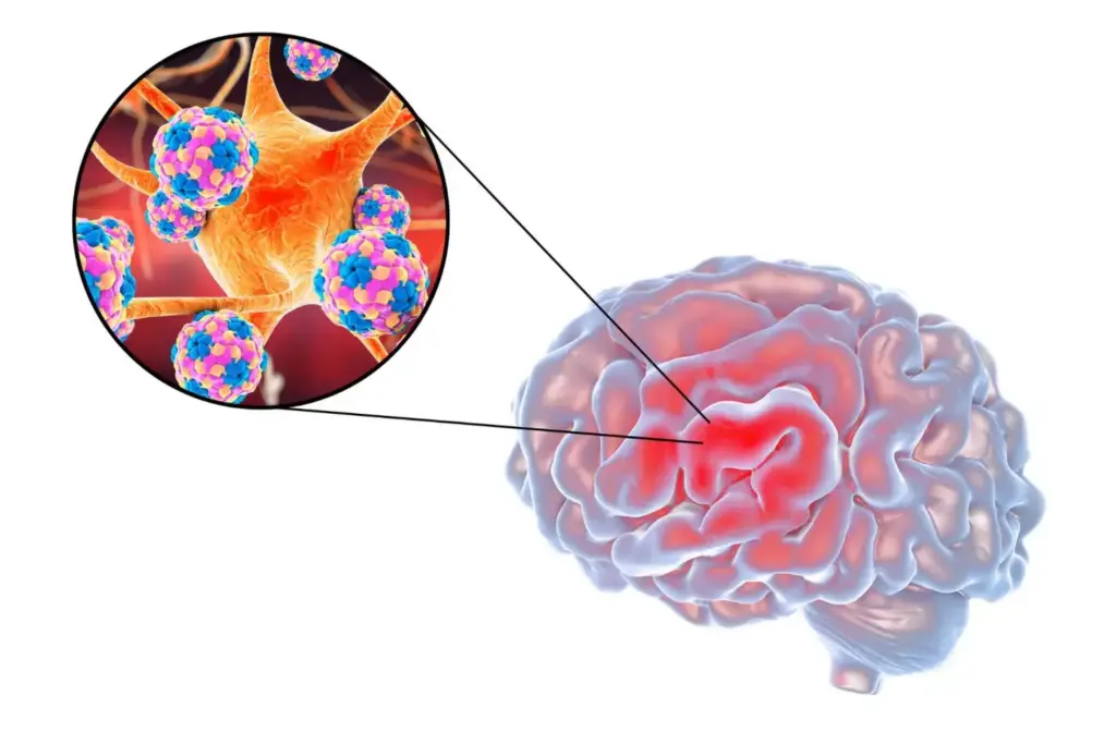 A detailed illustration of various brain tumor types, depicted in a clear, informative style. The foreground showcases a cross-section of the human brain, with different regions highlighted to represent common tumor types such as glioblastoma, meningioma, and pituitary adenoma. The middle ground features a series of labeled icons or diagrams that provide technical details about the characteristics, origins, and impacts of these tumor varieties. The background sets a clinical, subdued atmosphere with muted tones and subtle grid-like patterns, creating a sense of scientific study and analysis. Captured with a high-resolution, photographic lens to ensure clarity and precision in the visual representation of this complex medical subject matter.