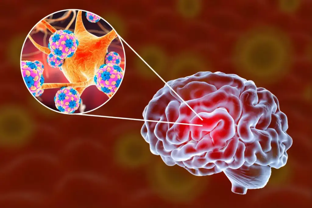 A detailed medical illustration depicting the general symptoms of a brain tumor. The foreground shows a human brain with various highlighted areas indicating common signs of a tumor, such as headaches, vision changes, cognitive issues, and motor function problems. The middle ground features transparent overlays with diagnostic icons and labels, providing context. The background is a clean, clinical environment with subtle grid patterns and soft lighting, conveying a sense of scientific objectivity. The overall composition and color palette aim to educate and inform without being overly graphic or disturbing.