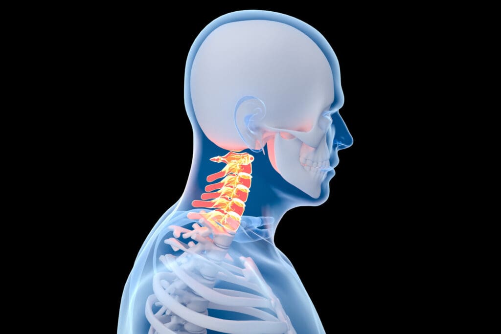 A detailed surgical illustration showcasing the recovery stages of a cervical spine procedure