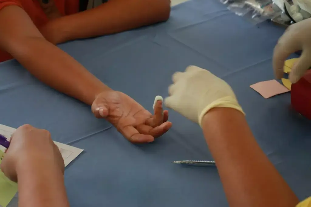 A detailed surgical scene depicting carpal tunnel release procedures. In the foreground, the surgeon's gloved hands carefully manipulate surgical tools, exposing the intricate anatomy of the wrist and palm. The middle ground shows the exposed carpal tunnel, with the transverse carpal ligament being carefully dissected. In the background, medical equipment and a sterile surgical environment provide context. The lighting is bright and clinical, highlighting the precision of the procedure. The camera angle is positioned to provide a clear view of the key anatomical structures and surgical steps involved in this common hand and wrist operation.