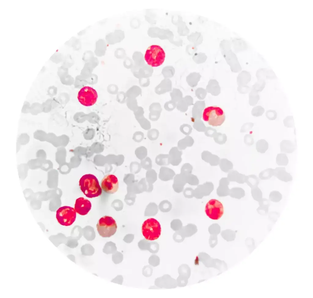 A high-contrast medical illustration depicting the typical range of white blood cell counts for cancer patients. In the foreground, a detailed cross-section of a single white blood cell, its nucleus and cytoplasm visible under a crisp microscope lens. In the middle ground, a graph with labeled axes showing the healthy and abnormal white blood cell count ranges, rendered with clean, minimalist infographic styling. The background is a muted, clinical palette of greys and blues, creating a calm, informative atmosphere to highlight the key medical data.