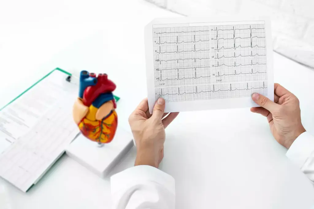 Abnormal Heart Rhythms on ECG