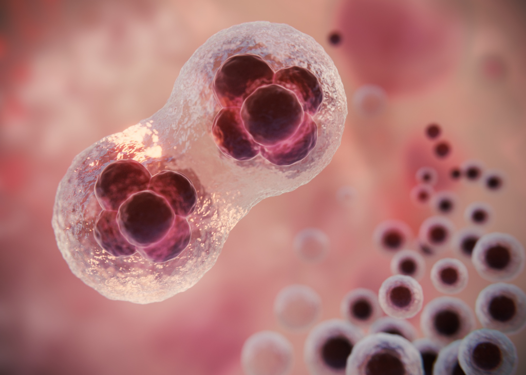 Acute Myeloid Leukemia Acute Myeloid Leukemia