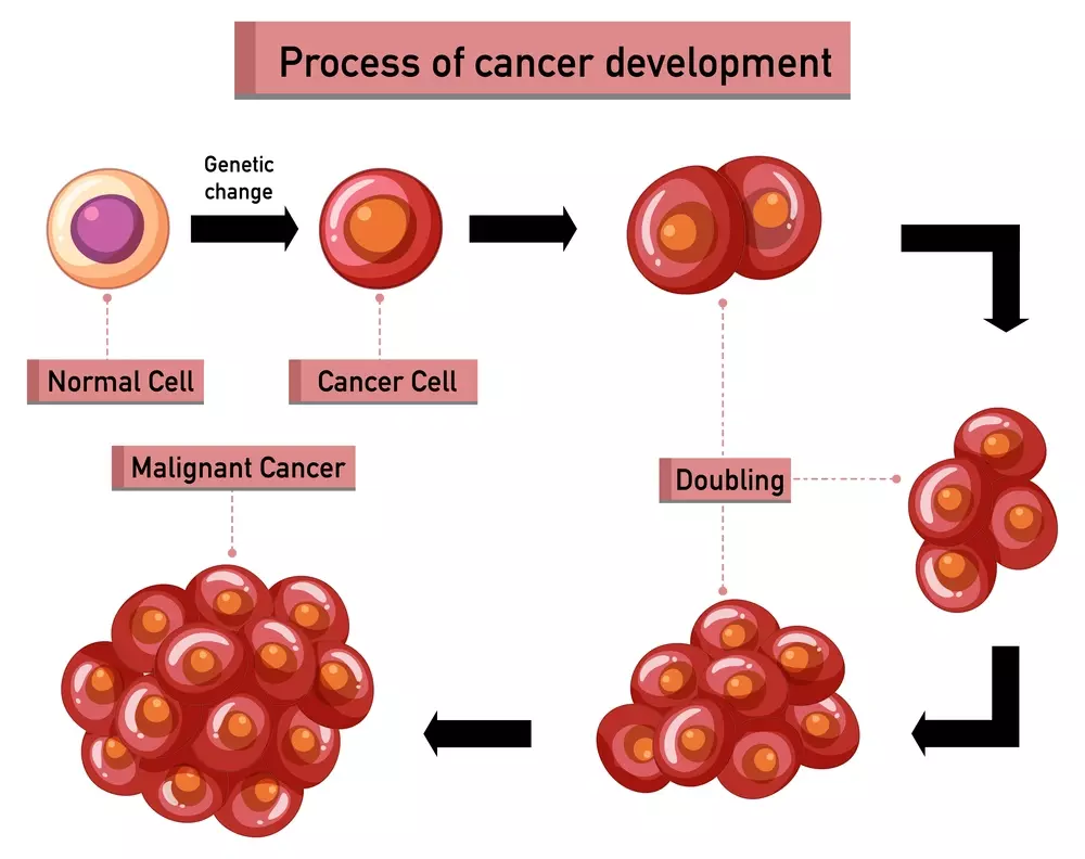 Acute Myeloid Leukemia, a hematological malignancy characterized by the rapid proliferation of immature myeloid cells in the bone marrow. In the foreground, a detailed illustration depicts the abnormal cells, their irregular shapes, and the disruption of normal blood cell production. The middle ground showcases the impact on the circulatory system, with blood vessels and organs affected by the disease. In the background, a somber, muted palette conveys the gravity of the condition, while subtle lighting emphasizes the complexity and severity of Acute Myeloid Leukemia. The overall composition evokes a sense of urgency and the need for deeper understanding of this challenging form of blood cancer.