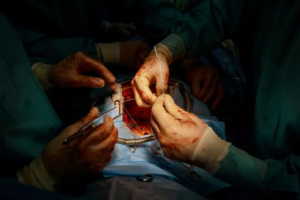 Aorta Surgery 