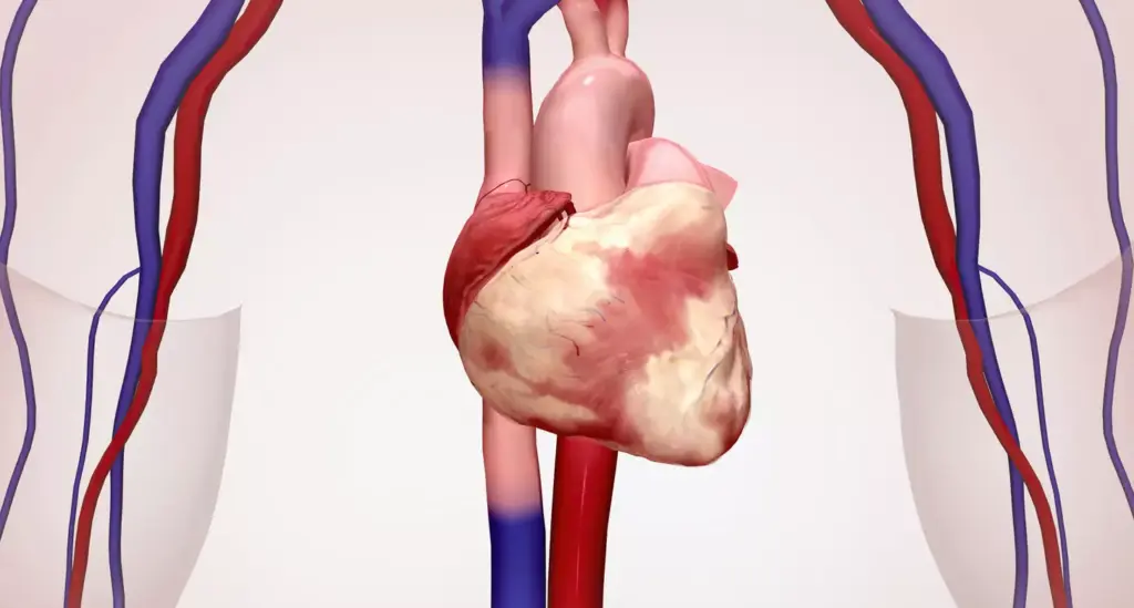 Aortic Tears and Their Life-Threatening Nature Aortic Tears and Their Life-Threatening Nature