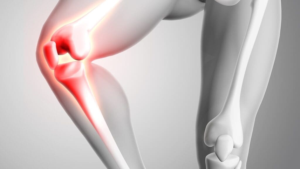 Arthroscopic Knee Surgery