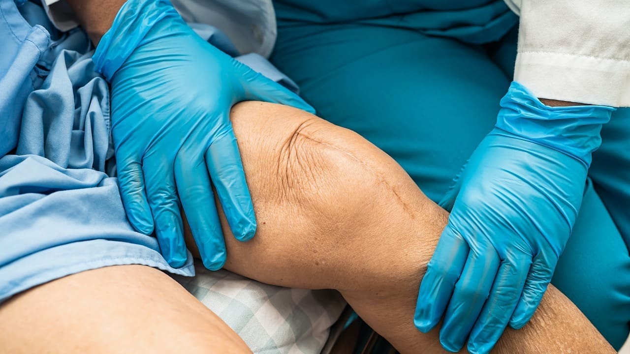 Arthroscopic Knee Surgery