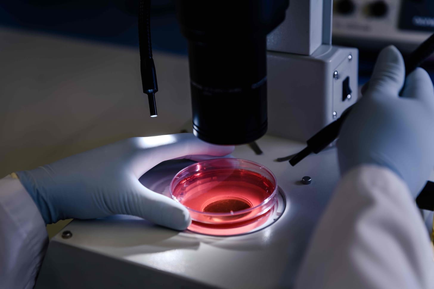 Autologous Stem Cell Transplant (ASCT)