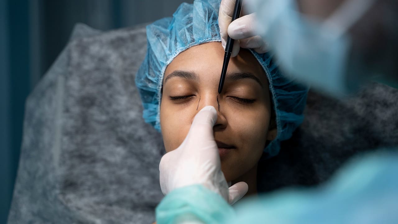 Basal Cell Carcinoma on the Nose with Mohs Surgery