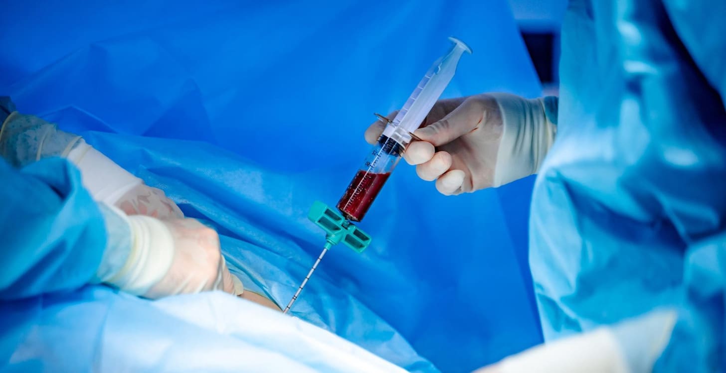 Bone marrow donation