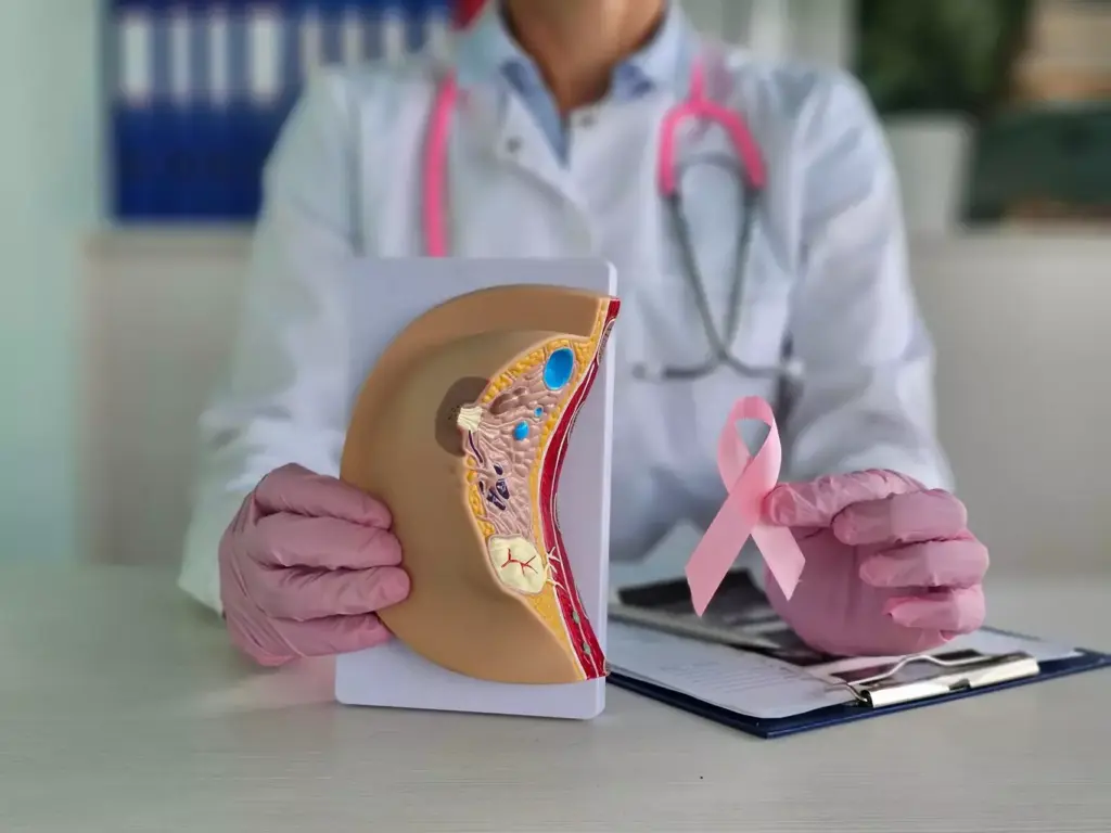 Breast Cancer Basics Breast Cancer Basics