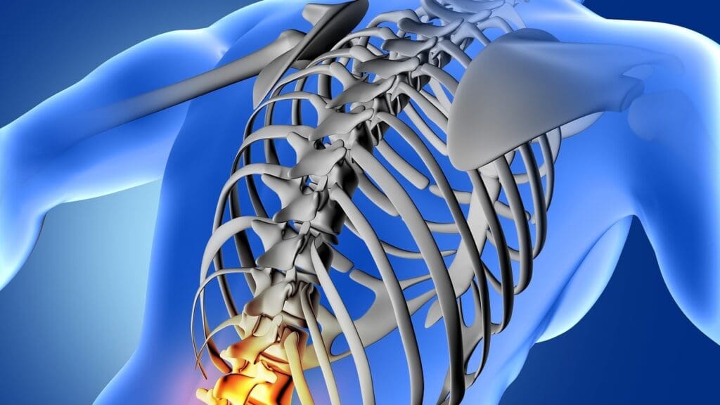 C3 Spinal Cord Injury, Fracture, and Recovery