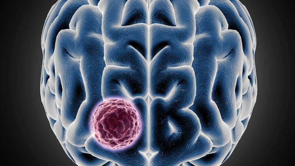 Causes of Brain Lesions