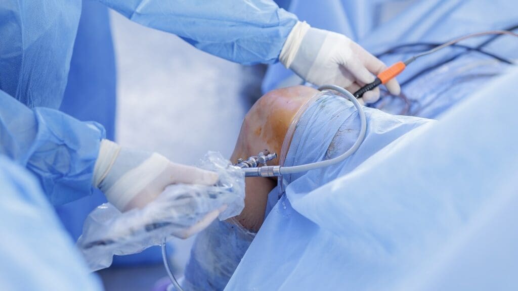 Cobalt Chrome vs Titanium Knee Replacement