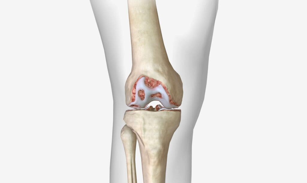 Detailed anatomical cross-section of the human knee,