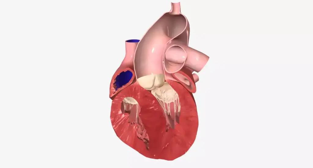 Detailed surgical rendering of a heart valve replacement procedure, showcasing the intricate anatomical structure of the heart valve and the surgical tools used in the operation. Precise cross-section view of the heart valve, with delicate textures of the valve leaflets and surrounding tissues. Warm, surgical lighting illuminates the scene, creating a sense of clinical professionalism. The image should convey the technical complexity and importance of this medical procedure, while maintaining a clean, informative aesthetic suitable for an educational article.