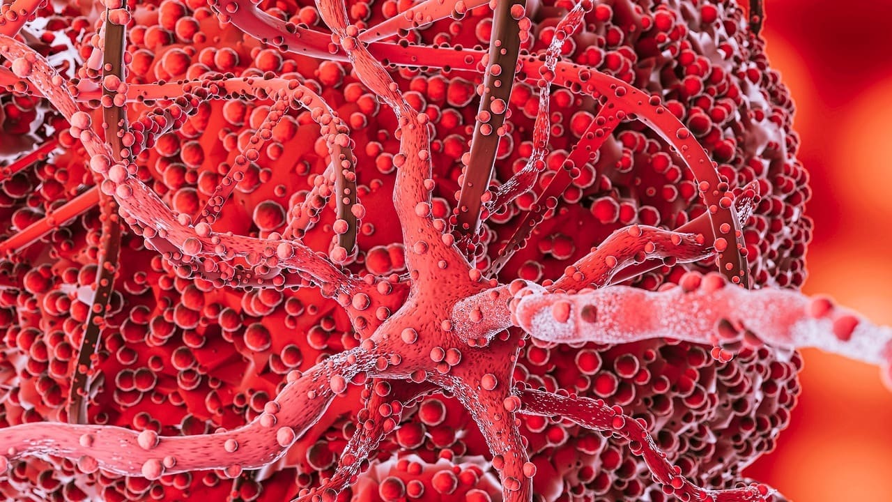 Diffuse Large B-Cell Lymphoma Treatment