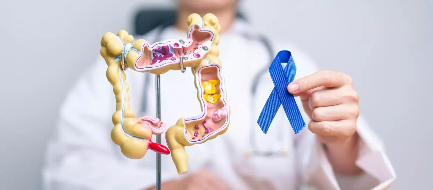 Doctor holding blue ribbon with human colon anatomy model march colorectal cancer a
