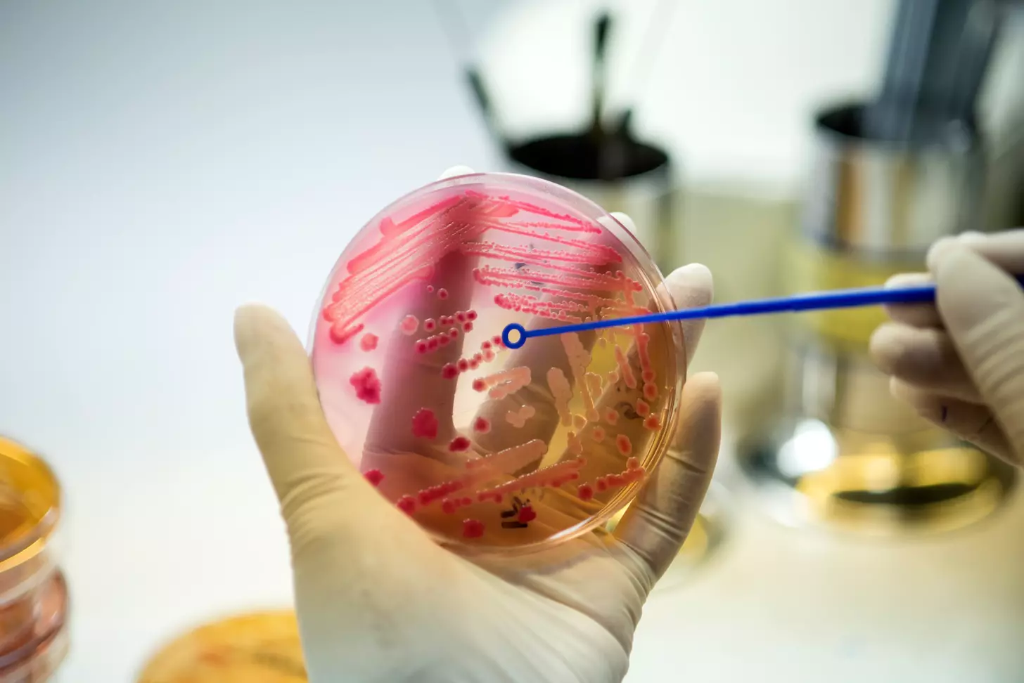 Embryonic stem cells obtained