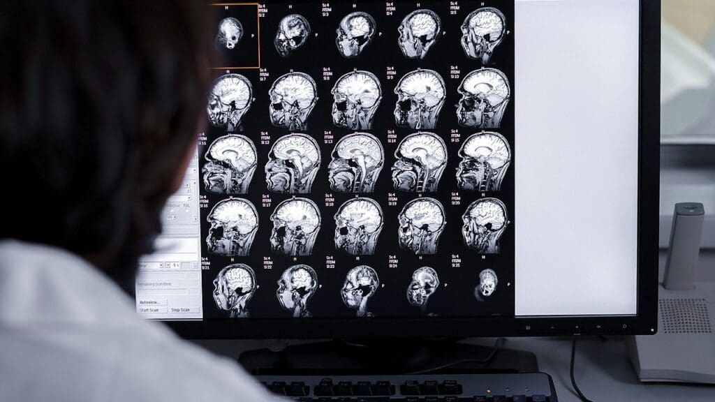Functional Magnetic Resonance Imaging
