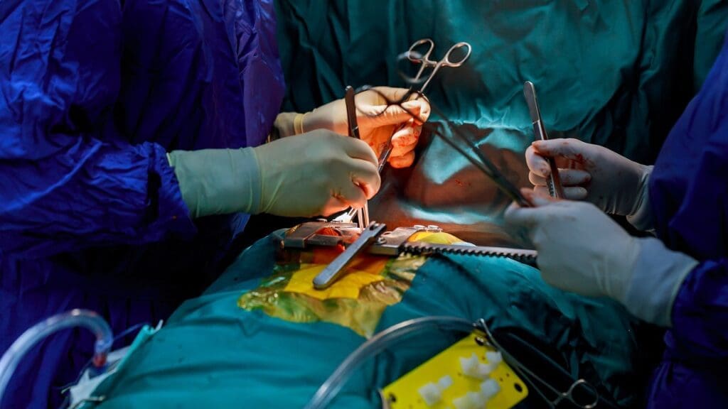 Heart Valve Repair Surgery
