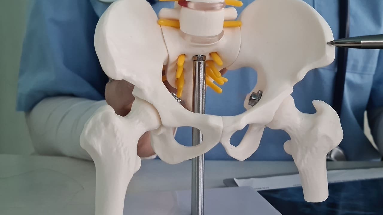 Hip Prosthesis Parts