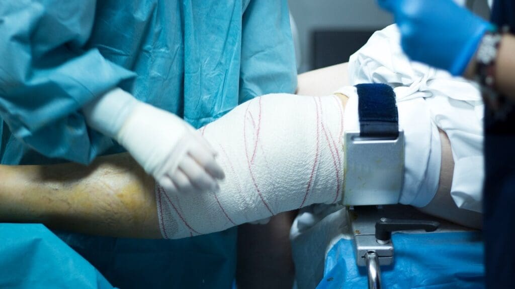 Knee Arthroscopy Surgery